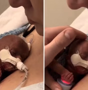 Mulher abraça seu bebê prematuro em 'despedida', mas acaba surpreendida pelo desfecho