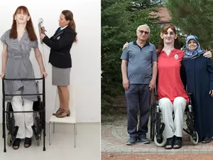 Mulher de 2,15 metros se torna a mais alta do mundo, aos 24 anos