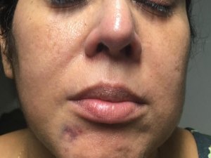 Homem suspeito de agredir servidora é afastado da Sima 