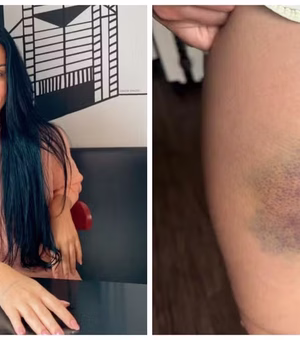 Nutricionista lutou por 13 minutos contra agressor que invadiu sua casa para estuprá-la: 'Briguei pela vida'