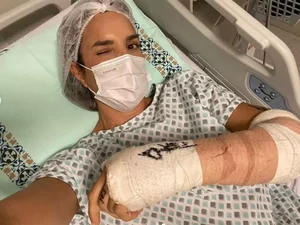 Ivete Sangalo passa por cirurgia no braço: ‘Mainha vai ficar zero bala’