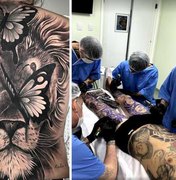 Conselho Federal de Medicina proíbe uso de anestesia para tatuagens estéticas