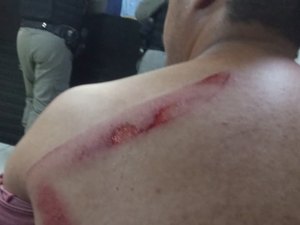 Polícia apura agressão com facão após desentendimento entre vizinhos em Maceió