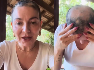 Mãe de Lucas Lucco revela volta da alopecia