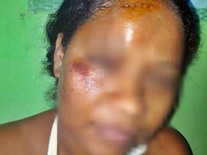 Marido agride esposa com golpes de barra de ferro