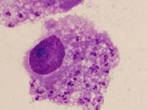 Alagoas não registrou infectados com novo parasita que assola Nordeste