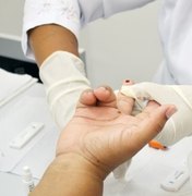 Hospital Helvio Auto oferece testes rápidos para detectar HIV