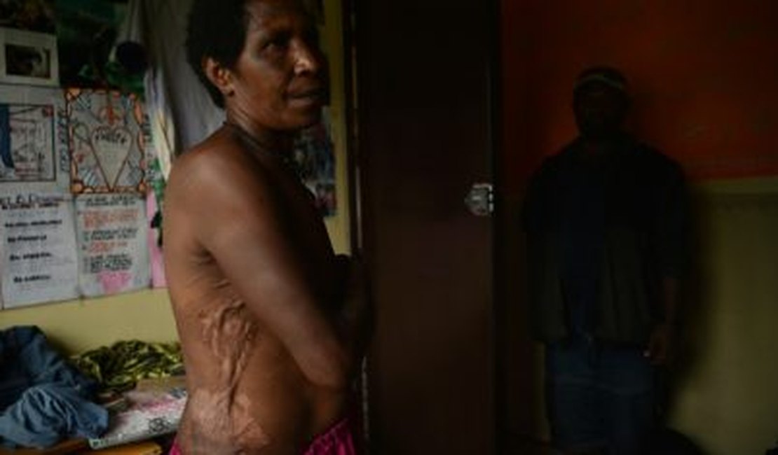 Caça às bruxas faz o terror imperar em Papua-Nova Guiné
