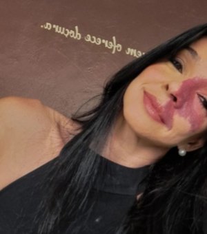 Empresária de Maceió morre em consequência de câncer cerebral