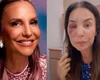 Ivete Sangalo mostra rosto com hematoma e esclarece estado de saúde