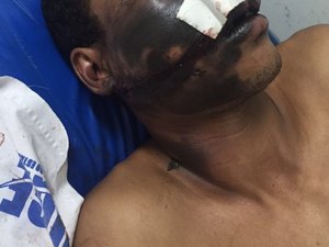 Celular explode enquanto carregava e homem fica ferido no interior