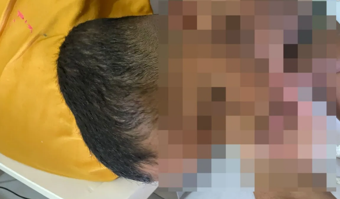 Família denuncia babá por agressões a criança autista de 5 anos em Arapiraca