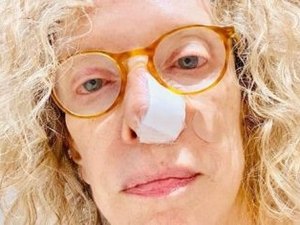 Marília Gabriela descobre câncer de pele e passa por cirurgia em São Paulo