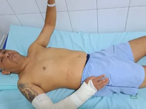 Árbitro tem pulso quebrado ao ser agredido por jogador