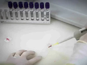 Paciente em SP com suspeita de ebola testa positivo para meningite
