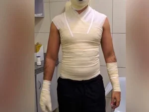 Homem sofre queimaduras graves ao fritar coxinha congelada em Goiânia