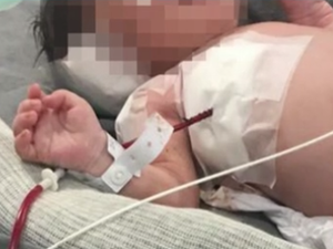 Bebê vítima de bala perdida na barriga da mãe nasce paraplégico, afirma secretário