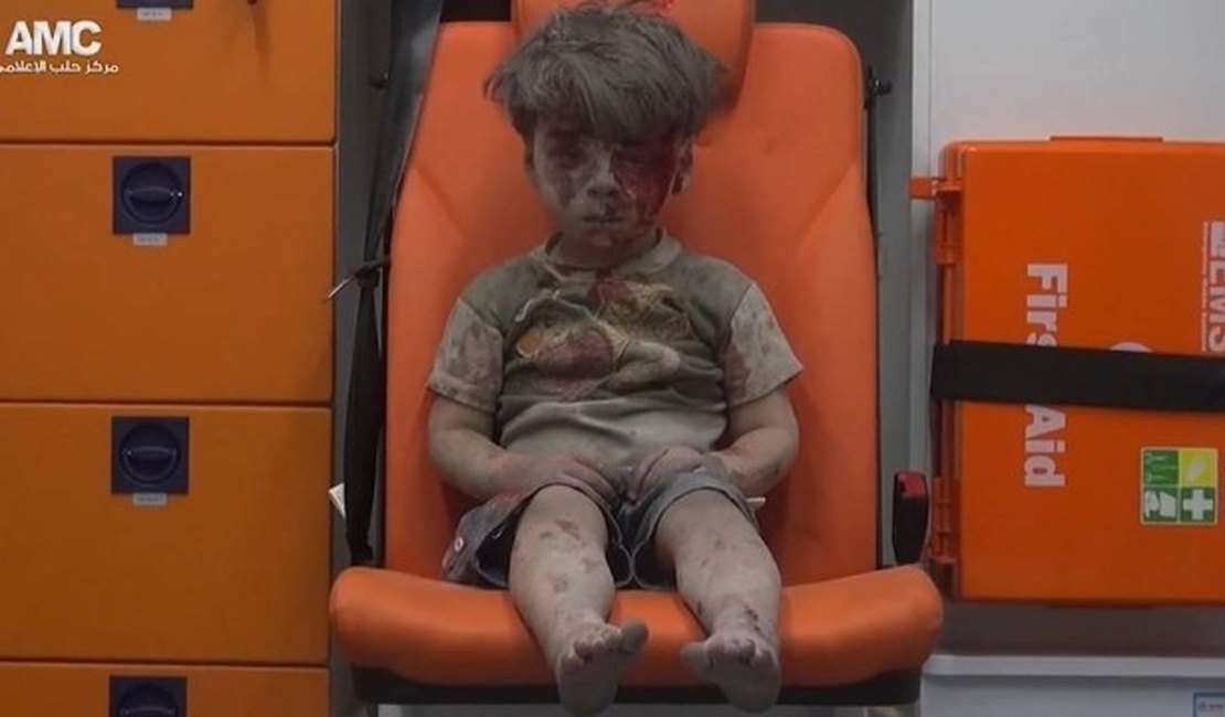 Imagem de criança Síria ensanguentada comove a web e expõe situação crítica no país