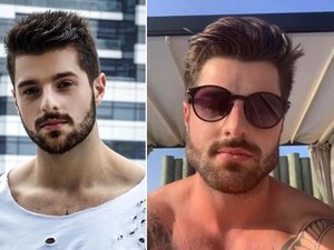 Saiba o que é a harmonização facial, processo que conquistou os famosos