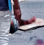 Motociclista se envolve em acidente no Sertão e tem fratura exposta