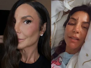 Ivete Sangalo retoma treinos após acidente doméstico e cirurgia