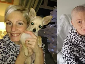 Chihuahua ajuda tutora a descobrir tumor maligno de 12 cm de modo inusitado