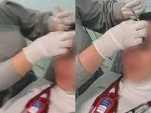 Médicas são demitidas após serem flagradas aplicando botox uma na outra