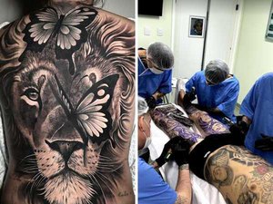 Conselho Federal de Medicina proíbe uso de anestesia para tatuagens estéticas
