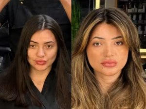 Veja antes e depois de suspeita de dar facada em cabeleireiro em SP