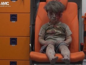 Imagem de criança Síria ensanguentada comove a web e expõe situação crítica no país