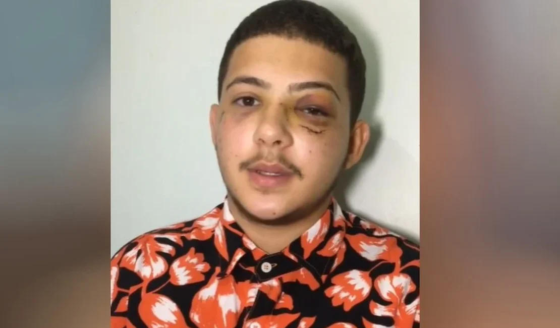 Jovem diz que foi agredido a socos por cantor sertanejo em Goiânia