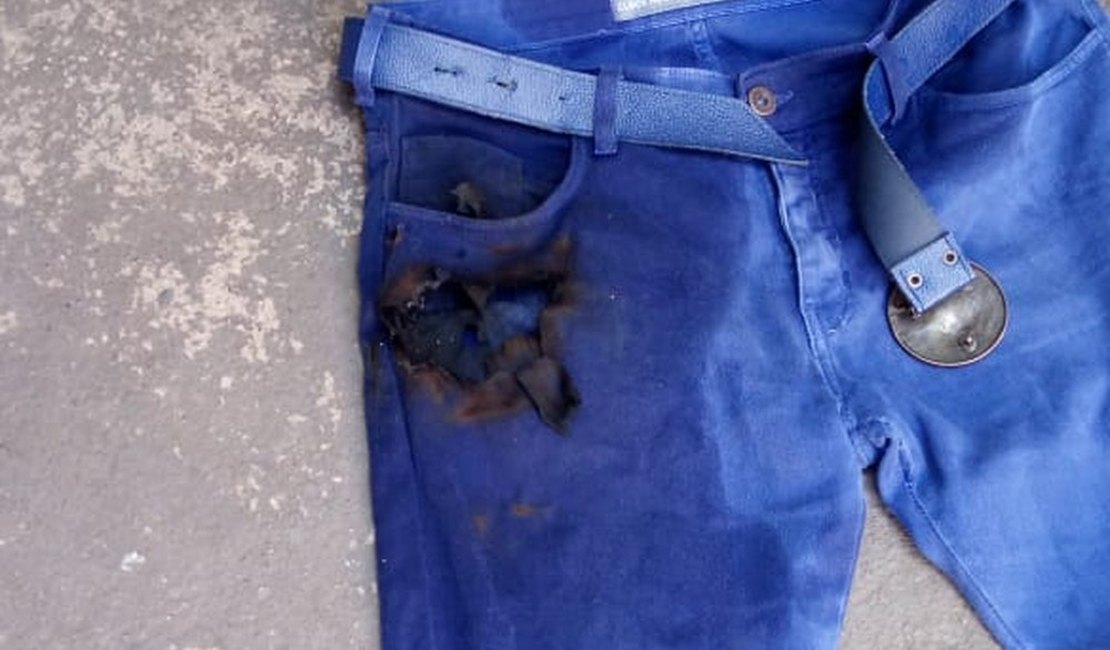 Enfermeiro tem queimadura na perna após celular explodir no bolso da calça