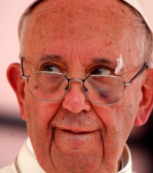 Papa Francisco se machuca sem gravidade no papamóvel