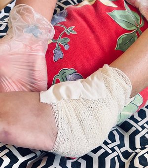 Especialistas do Hospital Dr. Ib Gatto atuam para prevenir úlceras por pressão em pacientes