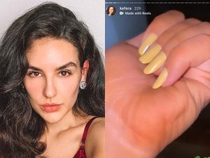 Kéfera fica laranja com autobronzeador: 'Não pode me deixar de quarentena'