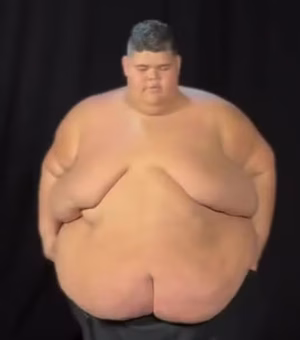 [Vídeo] Gordão da XJ mostra antes e depois de perder 130 kg