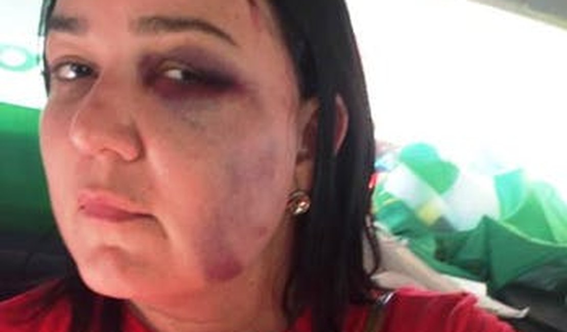 Mulher é agredida por eleitores de Bolsonaro após declarar voto em outro candidato em Maceió