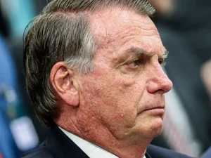 Bolsonaro pede autorização do STF para fazer procedimento médico
