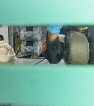 Médico de Bolsonaro diz que broncopneumonia é “potencialmente mortal”