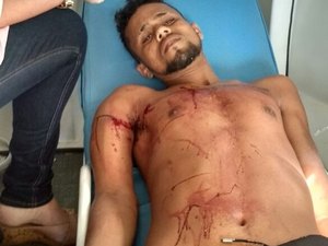 Briga entre rivais termina com duas pessoas gravemente feridas na Região Metropolitana