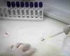 Paciente em SP com suspeita de ebola testa positivo para meningite