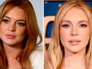 Lindsay Lohan gastou R$ 1,7 milhão para rejuvenescer, diz especialista