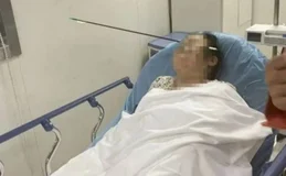 Mulher tem rosto atravessado por flecha de aço de 70 cm na China