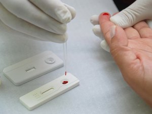 Procon Arapiraca realiza pesquisa para testes de Covid-19