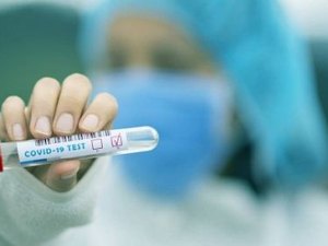 Teste de sorologia de Covid-19: ANS derruba liminar que garantia cobertura do exame