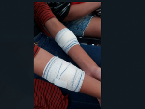 [Vídeo] Briga em ônibus escolar termina com três alunas feridas por golpes de estilete