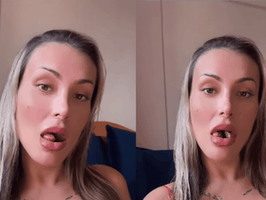 Andressa Urach exibe resultado final de bifurcação de língua; confira