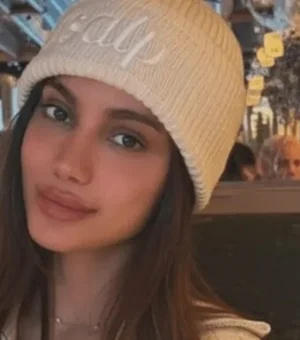 Anitta aparece com rosto diferente e web reage. Veja antes e depois