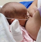 Partos prematuros acendem alerta para importância do pré-natal especializado