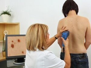 Uncisal promove ação sobre câncer de pele na orla de Pajuçara